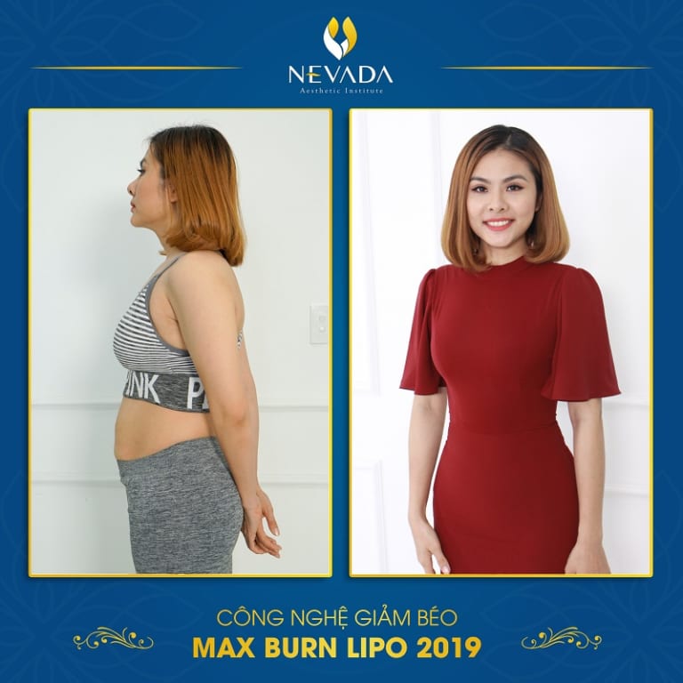 Giảm béo Max Burn Lipo có hiệu quả không?